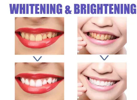 Dentifrice ultra blanchissant V34 : votre solution parfaite pour blanchir vos dents naturellement sans chirurgie et sans effet effet secondaire.