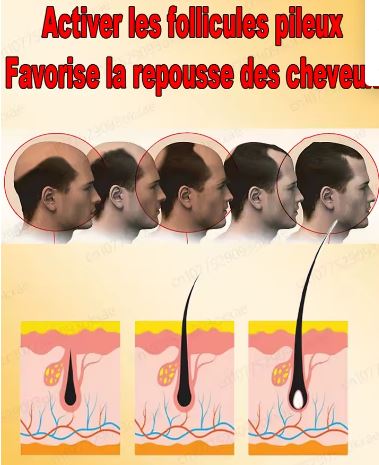 Huile capillaire Disaar : repousse rapide des cheveux et barbes, Chevelure Dense et Volumineuse – La Solution Naturelle à la Chute de Cheveux